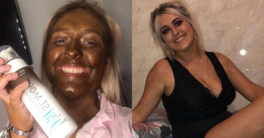 Image principale de l'article Elle choisit un autobronzant trop foncé