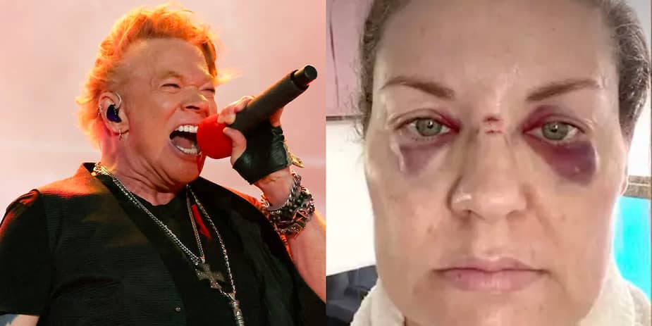 Image principale de l'article Un micro lancé par Axl Rose frappe une femme