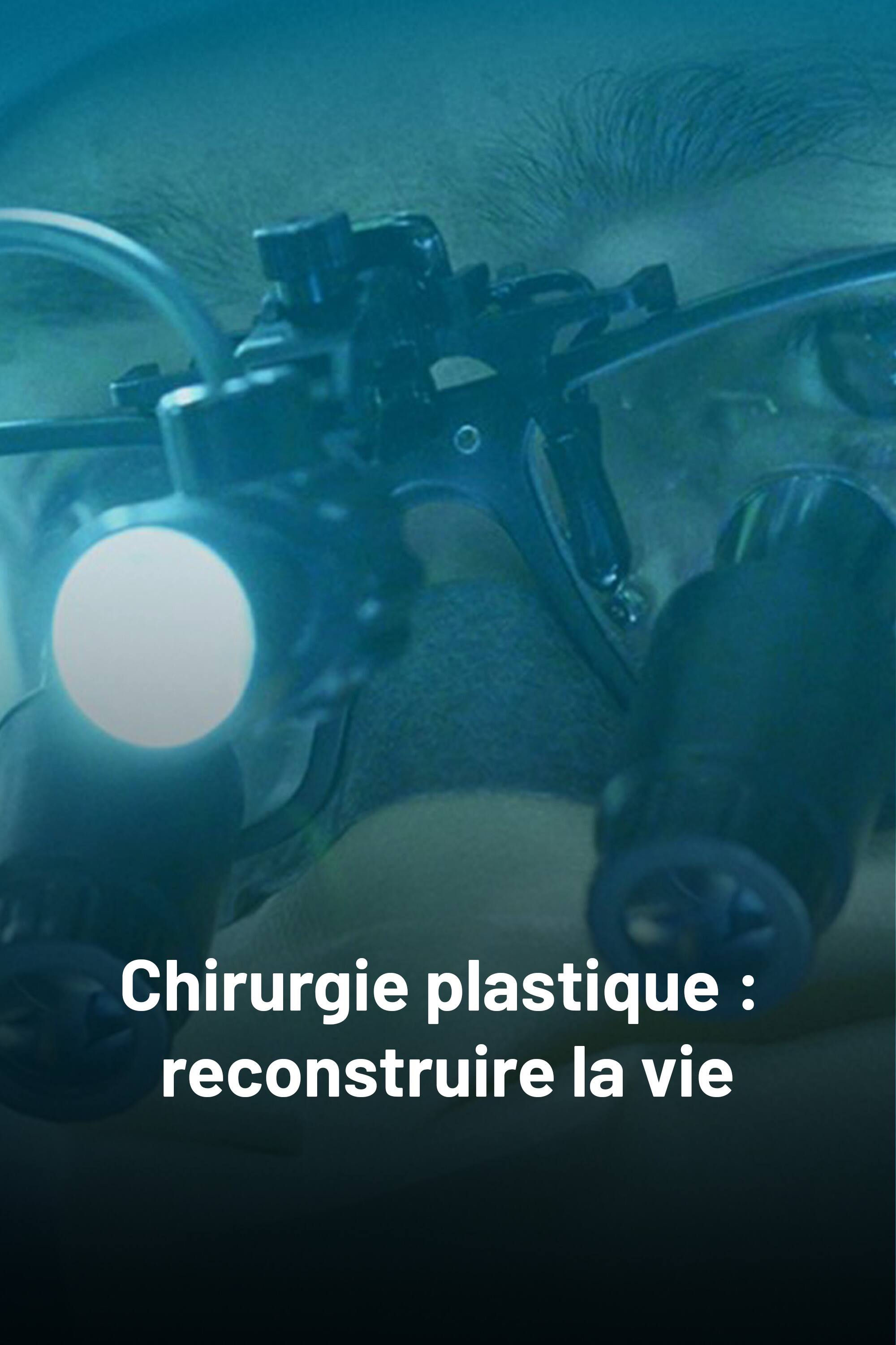 Chirurgie plastique : reconstruire la vie