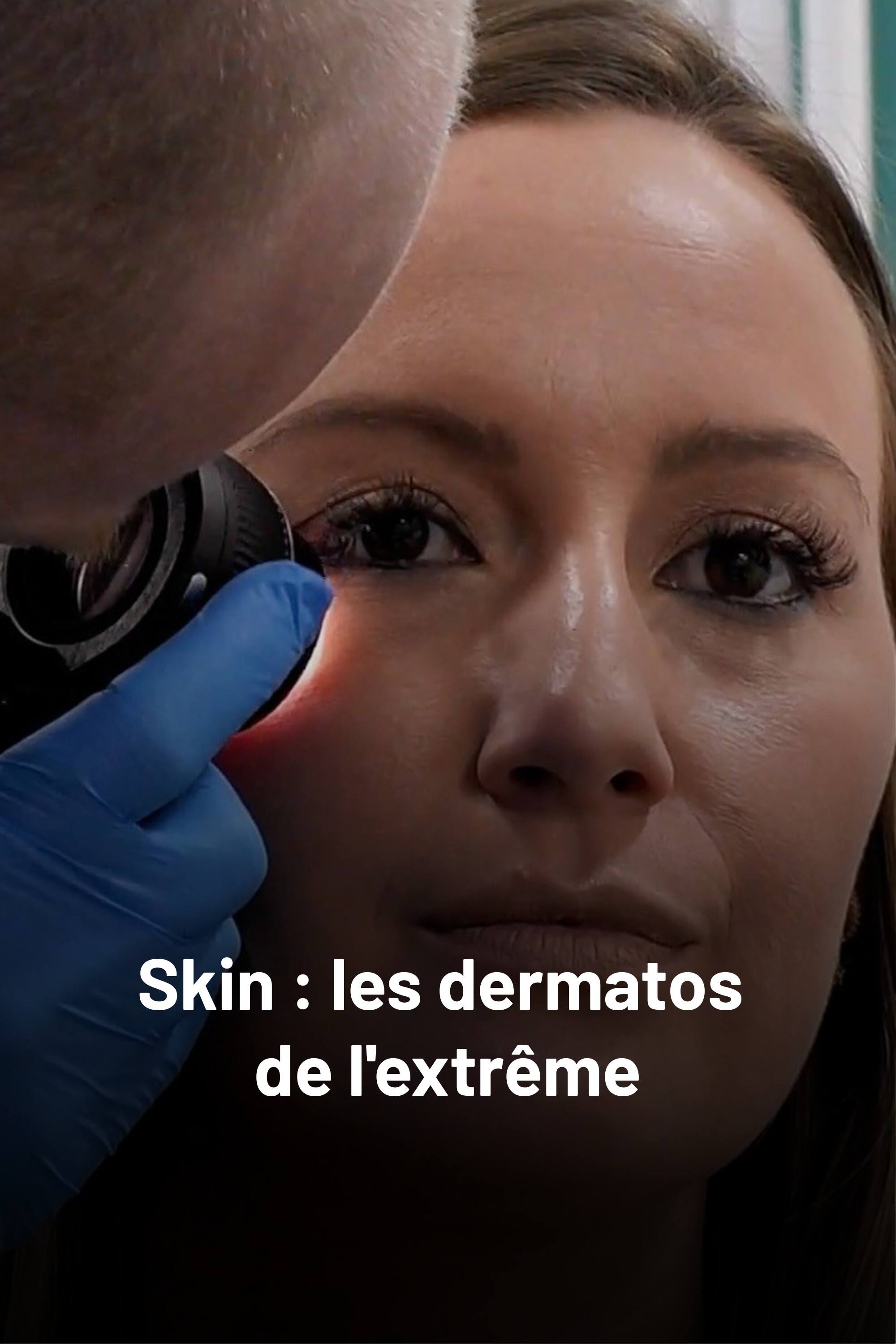 Skin : les dermatos de l'extrême