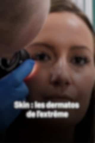 Skin : les dermatos de l'extrême